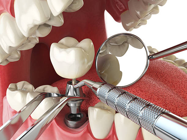 Best Walk-In Emergency Dentist in West Samoset, FL